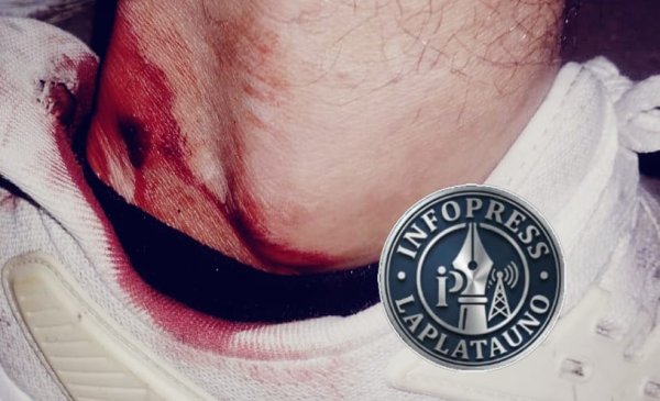 TENSI&Oacute;N Y DISPAROS EN CHASCOM&Uacute;S: UN POLIC&Iacute;A BONAERENSE FUE APREHENDIDO TRAS HERIR A UN VECINO ?