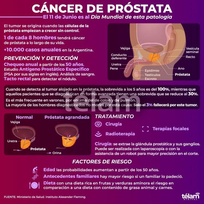 Día Mundial del Cáncer de Próstata: cifras y pronóstico