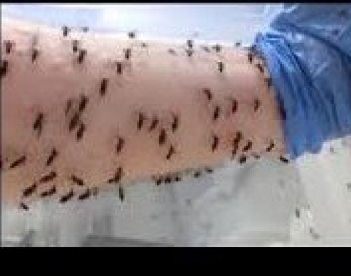 INVASIÓN DE MOSQUITOS EN LA PLATA.